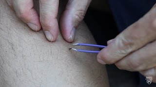 Mayo Clinic Minute Tips to best remove ticks [upl. by Cul]