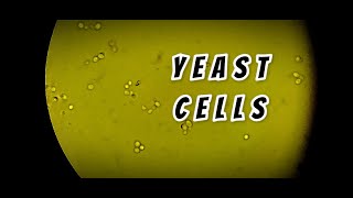 Yeast cells in stool routine Microscopy  labmedicine9265 [upl. by Runkle]