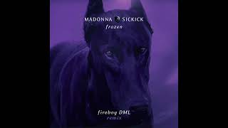 Madonna Vs Sickick  Frozen Fireboy DML Remix [upl. by Idnahs981]