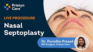 Deviated Septum Surgery  Endoscopic Septoplasty Explained  Pristyn Care [upl. by Parette]