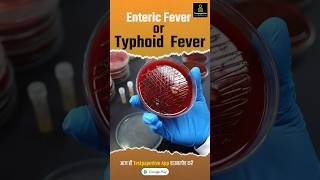 Enteric Fever and typhoid Fever  Cause  Symptoms Diagnosis EntericFever typhoidfever shorts [upl. by Farlie]