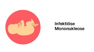 Infektiöse Mononukleose  Infektionskrankheiten  Kinderkrankheiten [upl. by Derayne]