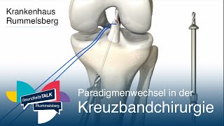 Paradigmenwechsel in der Kreuzbandchirurgie  GesundheitsTALK Rummelsberg [upl. by Aidam]