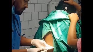 Epidural Analgesia Painless delivery Pregnant doctor injection [upl. by Damaris]