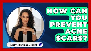 How Can You Prevent Acne Scars  LearnToDIY360com [upl. by Elizabet]