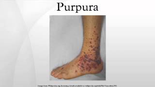 Purpura [upl. by Aelahs]