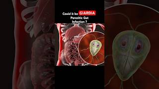 Giardia Infection is often mistaken for IBS Symptoms guthealth shorts youtubeshorts [upl. by Ijan]