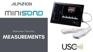 Alpinion Minisono Tutorial Measurements [upl. by Olaznog]