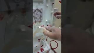 Hemodialysis Bbraun Priming part 1 [upl. by Eeldivad885]