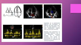 Ecocardiograma modo Doppler [upl. by Elacsap]