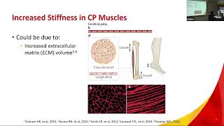 the impact of collagenase on passive and active properties of muscles in children with CP by F Syed [upl. by Rochelle]