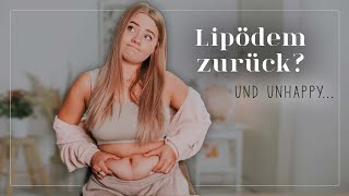 Ein ehrliches Body Update – Lipödem amp Ernährung KaTeaTime [upl. by Godwin836]