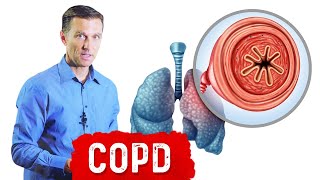 Chronic Obstructive Pulmonary Disease COPD [upl. by Einahpts]