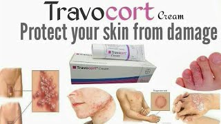 Travocort Isoconazole Nitrate and Diflucortolone Valerate cream for RednessinflamationNappy Rash [upl. by Bock862]