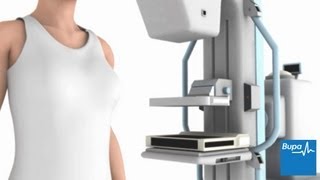 How a mammogram is carried out  Bupa Health [upl. by Siraj959]