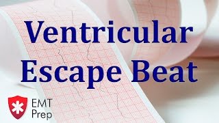 Ventricular Escape Beat ECG  EMTprepcom [upl. by Avi]