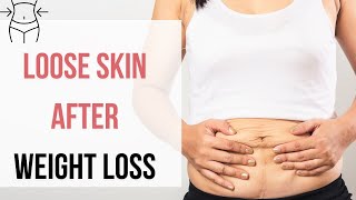 Heres the REMEDIES to Handle Loose Skin After Extreme Weight Loss [upl. by Georges365]