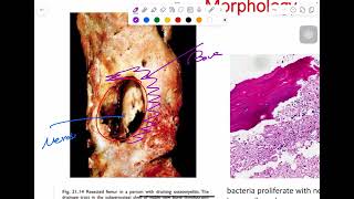 MSS pathology lab 2  part 1 [upl. by Kral316]