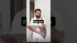 Fatty liver घर के खाने की ताकत को पहचानो drrobin health food ayurved doctor facts remedy [upl. by Farhsa394]