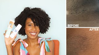 How to Get Rid of Ingrown Hairs and Dark Marks On The Bikini Line  PFB Vanish [upl. by Atirys802]