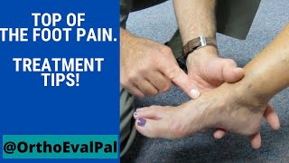 Top of the foot pain Treatment tips [upl. by Dene]