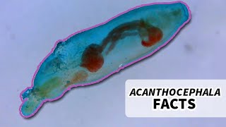 Acanthocephala Facts the Thorny Headed Worm  Animal Fact Files [upl. by Enelime703]