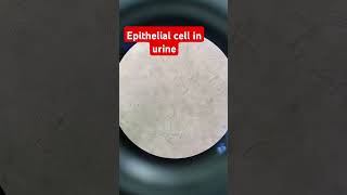 Epithelial cells in urine [upl. by Sucramraj]