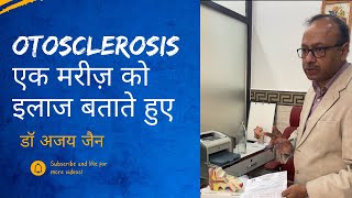 ओटोस्क्लेरोसिस के एक मरीज की काउंसलिंग करते हुए ईएनटी सर्जन।otosclerosis [upl. by Harod]