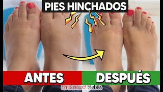 🦶🏻🔥 4 FORMAS de disminuir los PIES HINCHADOS durante el embarazo [upl. by Mahoney896]