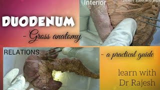 DUODENUM Specimen demo [upl. by Hplodnar269]