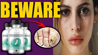 KERASSENTIALS  🚨BEWARE🚨  Kerassentials Oil Nail Fungus  Kerassentials Review [upl. by Ahsinev]