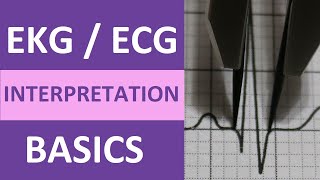 EKGECG Interpretation Basics Nursing NCLEX  QRS Complex P Wave T Wave PR Interval [upl. by Egdamlat]