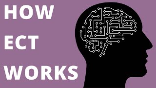 How ECT Works electroconvulsive therapy [upl. by Neirod265]