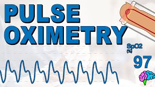 What is Pulse Oximetry [upl. by Ardena]