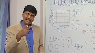 ಶಶಿ ಇಸಿಜಿ ಕನ್ನಡ ಭಾಗ  1 Shashis ECG in Kannada  Part 1 [upl. by Aenehs]