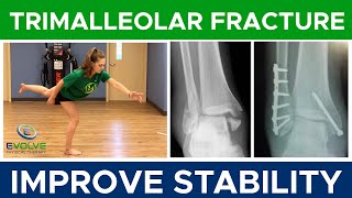 Trimalleolar Fracture  Improving Dynamic Ankle Stability  Part 1 [upl. by Enelrac]