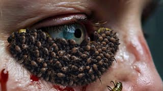 ASMR Treatment Eye  ASMR Eye Animation Removal Maggots [upl. by Byrne]