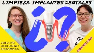 LIMPIEZA DE IMPLANTES DENTALES 🦷 con Dra Edith Godínez Padilla [upl. by Valoniah]