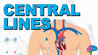 The Basics of Central Lines  Central Venous Catheters CVC [upl. by Yelnahs860]