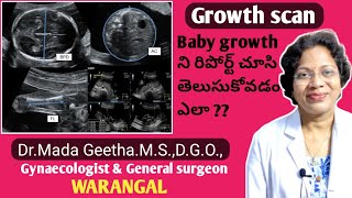 8 month pregnancy scan report Foetal growth scan in Telugu 32 weeks pregnancy scanDrMada Geetha [upl. by Halac]