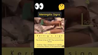 Meningitis Signsmedical [upl. by Volding]