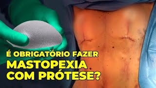 É OBRIGATÓRIO FAZER MASTOPEXIA COM PRÓTESE [upl. by Philipa]