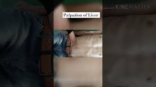 Liver Palpation  Clinical Examination of Abdomen clinical physiology mbbs [upl. by Uzia]