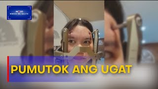 24anyos na babae mula Leyte naputukan ng ugat sa utak  MukhaNgBalita [upl. by Chick786]