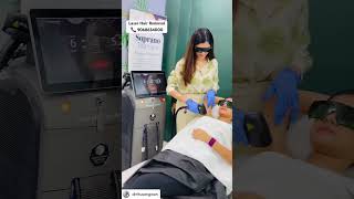 Laser Hair Removal for underarms at Tira Clinic Rohtak laser laserhairremoval hairremoval [upl. by Assetniuq]