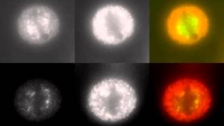 Livecell imaging of rapamycininduced rerouting of TACC3 to mitochondria [upl. by Vez]