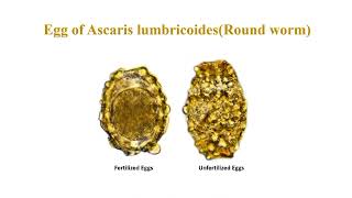 Ascaris lumbricoides egg morphology characteristics and identification [upl. by Norine]