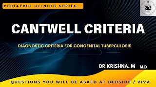 CANTWELL CRITERIA Congenital Tuberculosis [upl. by Purcell]