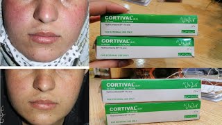 Cortival Medicated Cream  Cortival Cream UsesBenafits amp Side Effects Cortival Cream Honest Review [upl. by Mechling]