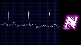 Sonido de monitor cardiaco  Heart monitor sound effect  Ekg sound  Sonido electrocardiograma [upl. by Enomad658]